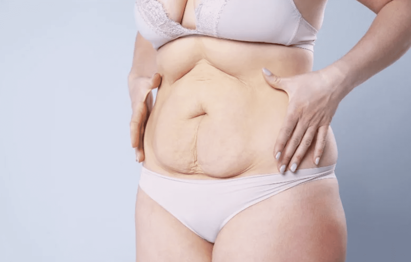 Tummy Tuck in Dubai