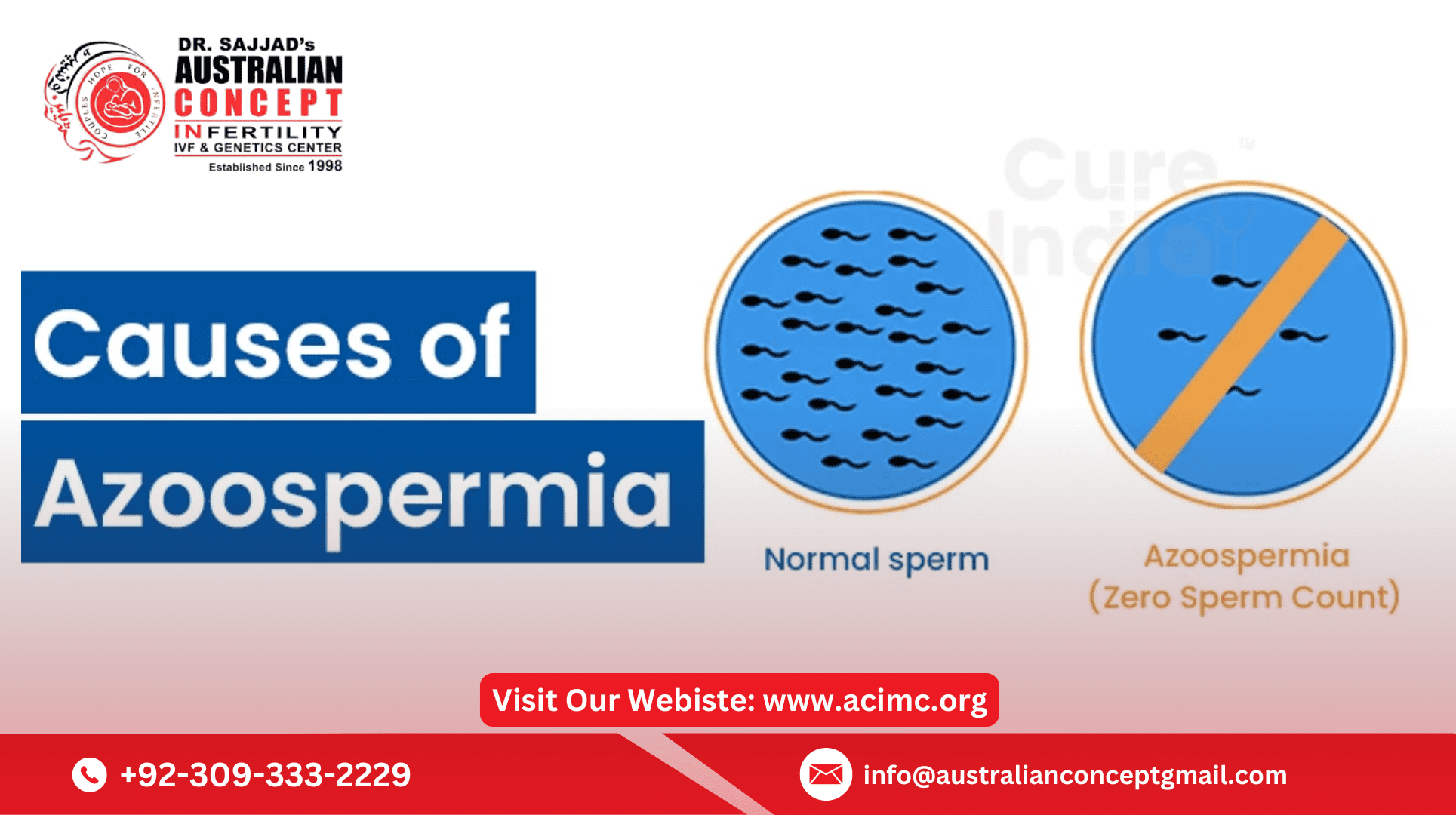 Azoospermia Treatment