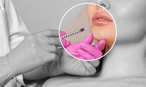 Maintain a Radiant, Youthful Glow with Natural Adjustments in Richmond 2 Lip Filler