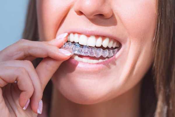 Quick Appointments, Confident Smiles – Brighton 3 orthodontist Brighton
